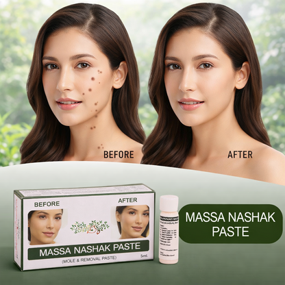 Ayurvedic Massa Removal Cream | Natural Wart & Skin Tag Remover | Herbal Mole Removal Solution (Easy & Safe Use)