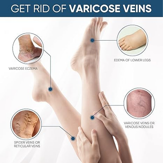 Varicose Veins Relief Patch | Herbal Leg Care Pads for Pain, Swelling & Blood Circulation Support (12 PCS)
