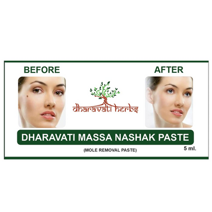 Ayurvedic Massa Removal Cream | Natural Wart & Skin Tag Remover | Herbal Mole Removal Solution (Easy & Safe Use)