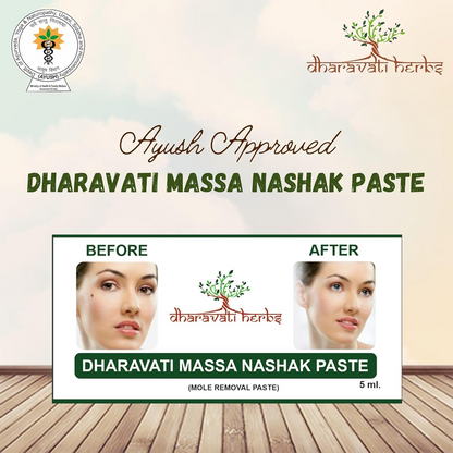 Ayurvedic Massa Removal Cream | Natural Wart & Skin Tag Remover | Herbal Mole Removal Solution (Easy & Safe Use)