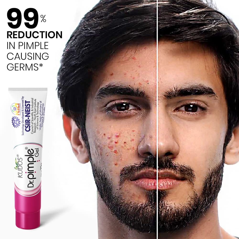 Kudos Dr. Pimple Gel | Ayurvedic Anti Acne Treatment | Reduces Pimples, Marks & Oil | Fast Acting, Oil-Free Formula | For Clear & Healthy Skin (25g)