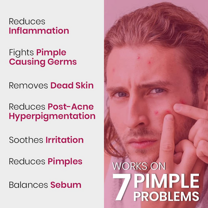 Kudos Dr. Pimple Gel | Ayurvedic Anti Acne Treatment | Reduces Pimples, Marks & Oil | Fast Acting, Oil-Free Formula | For Clear & Healthy Skin (25g)